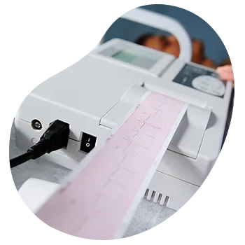 Prueba de Ecocardiograma