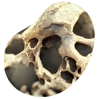 Densitometría ósea